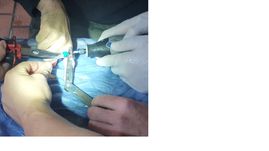 EB 665 „TH 0 – Ring am Finger muss entfernt werden“ OT Schötmar